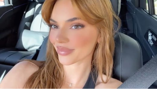 Kendall Jenner's New Lips