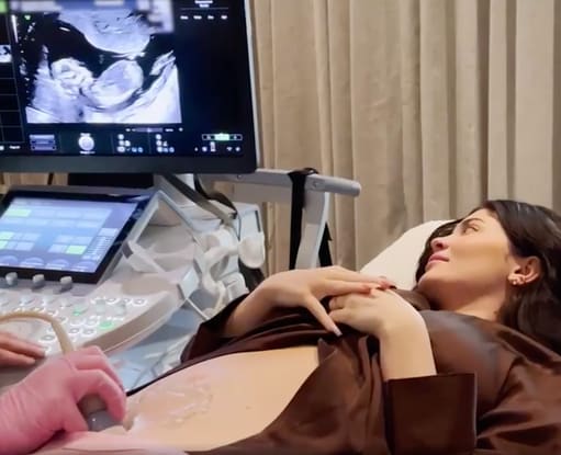 Kylie Jenner Ultrasound Photo