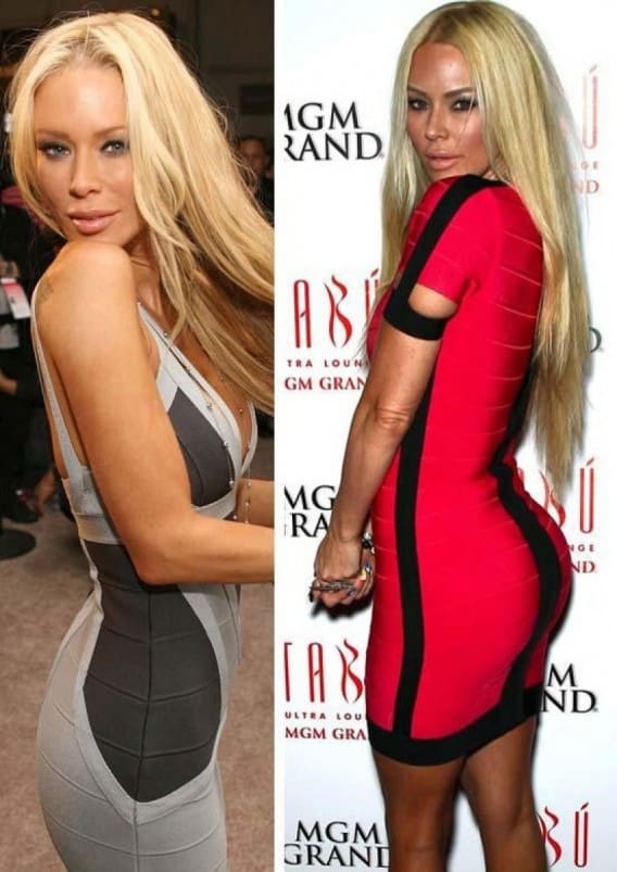 Celebs With Butt Implants